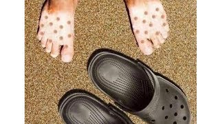 WRONG CHOICE OF SHOES FOR A SUNNY DAY!