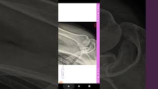 RadGuide 3D Positioning Radiography Xray app screenshot 2