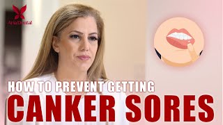 Canker Sores Aria Dental Maryam Horiyat Dds.