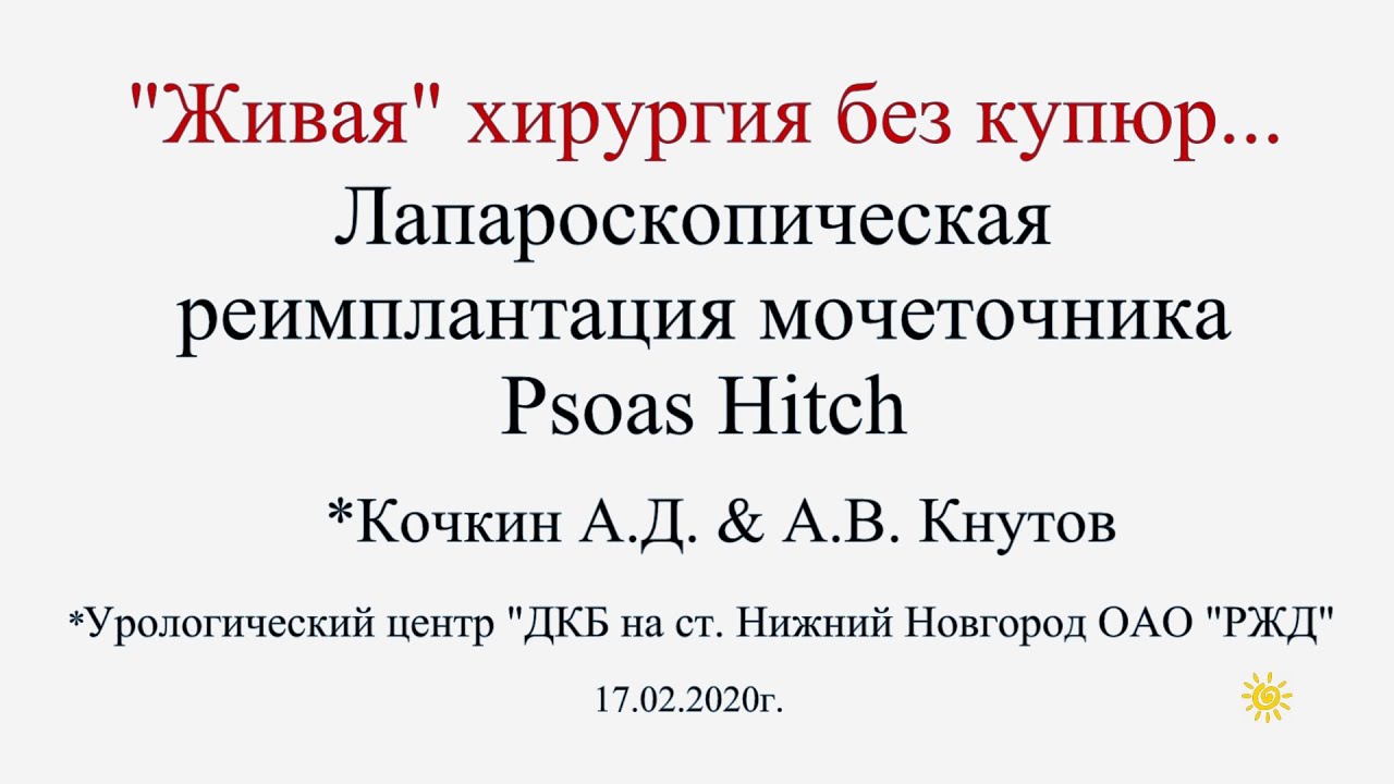 Live psoas hitch/Живая хирургия/Псоас хитч/пластика мочеточника