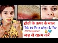 होठो के ऊपर के बाल,Upper Lips Hair 1 बार में जड़ से खत्म facial Hair Treatment  फिर वापस नहीं आएंगे