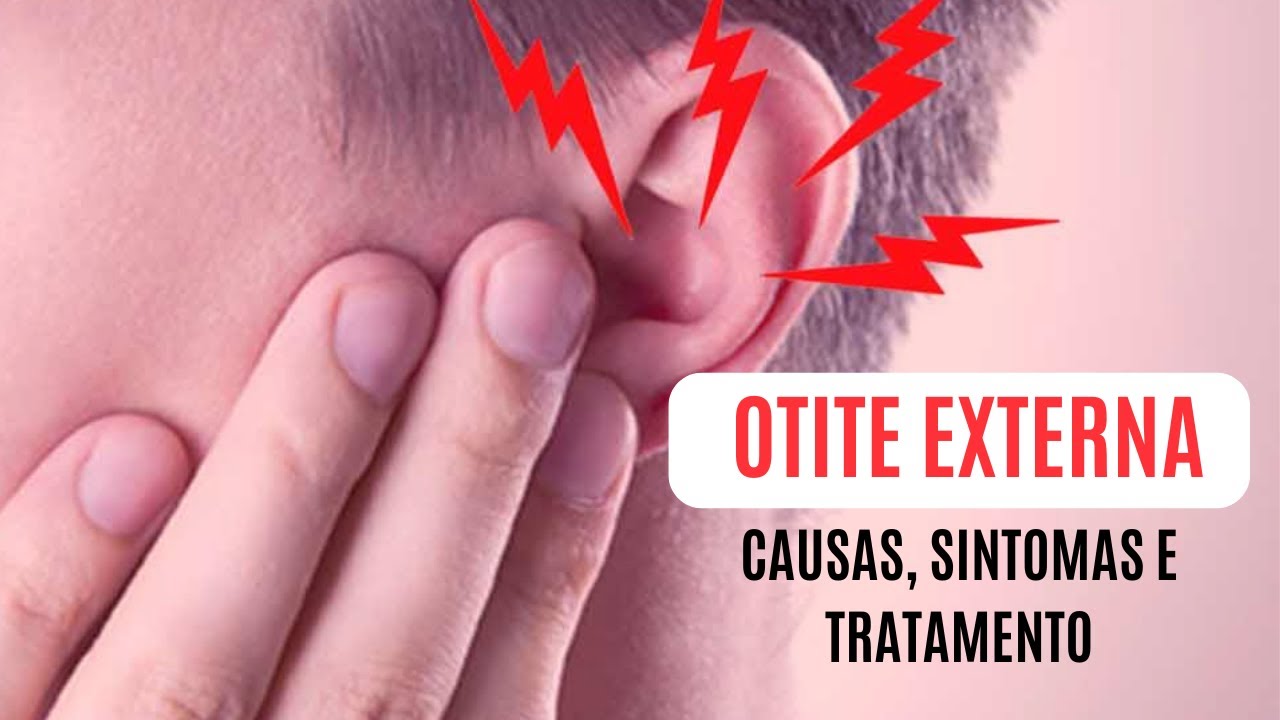 6 melhores remédios caseiros para se livrar da otite externa #0051 ...