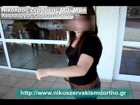 Συντριπτικό κάταγμα αγκώνα - Elbow fracture