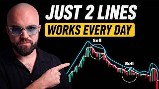 The 1 Minute Scalping Strategy That Makes Me $10,000/Week (Step by Step)