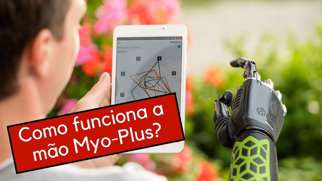 Como funciona o sistema Myo-Plus para mãos protéticas.