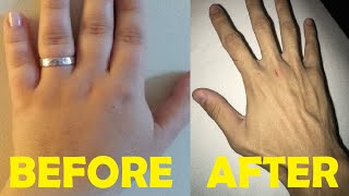 how to get rid of chubby hands
