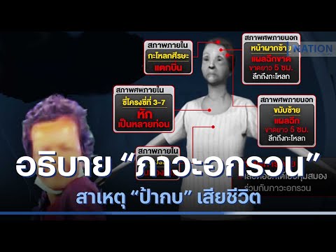 เพจดังอธิบาย "ภาวะอกรวน" สาเหตุ "ป้ากบ" เสียชีวิต | เนชั่นทันข่าวเช้า | NationTV22