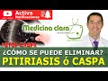 Caspa, claves para eliminar la caspa de forma efectiva. Relación caspa y calvicie | Medicina Clara