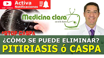 ¿Cómo puedo detener rápidamente el picor de la psoriasis?