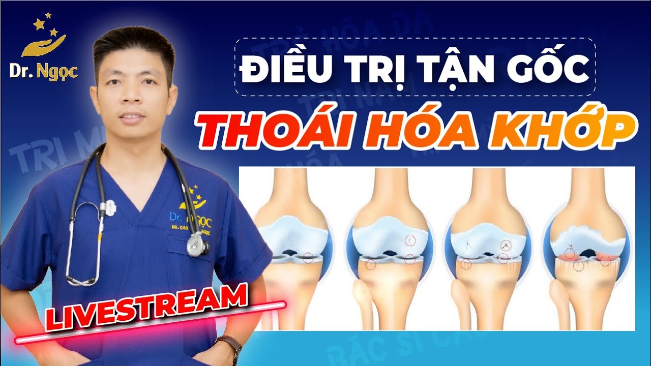 Điều Trị Tận Gốc Thoái Hoá Khớp