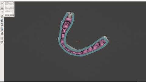 Meshmixer - preparation of orthodontic stl for clear aligner fabrication