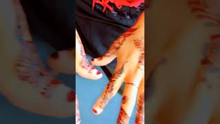 Asxbta cilaankas waxka dhaha midkle halyso dhwyo