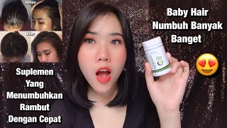 Suplemen Obat Untuk Mempercepat Menumbuhkan Rambut Botak Dan Rontok