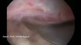 Hayati Aygün-5