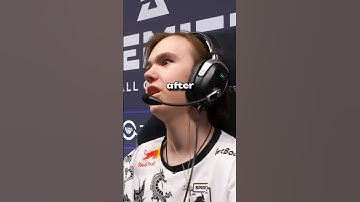 ZONIC IS BETTER THAN DEV1CE #cs2 #csgo #cs2moments