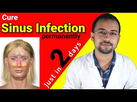 Video: How To Determine Sinusitis At Home In Adults And Children Without A Doctor