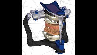 Dynamic Articulation Optional Module