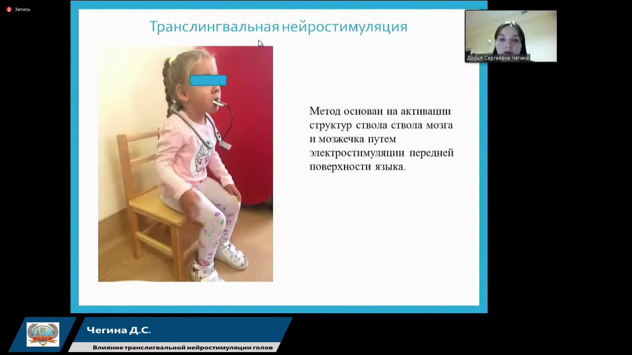 Базальная стимуляция для детей с дцп - фото презентация