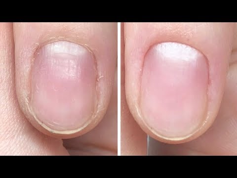 Video: 3 Möglichkeiten, kurze Nägel zu maniküren