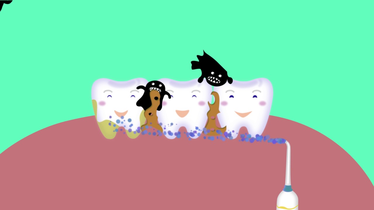 Ирригатор Jetpik - инновационная технология по уходу за зубами и деснами.