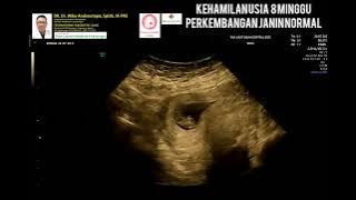 Kehamilan 8 minggu perkembangan normal
