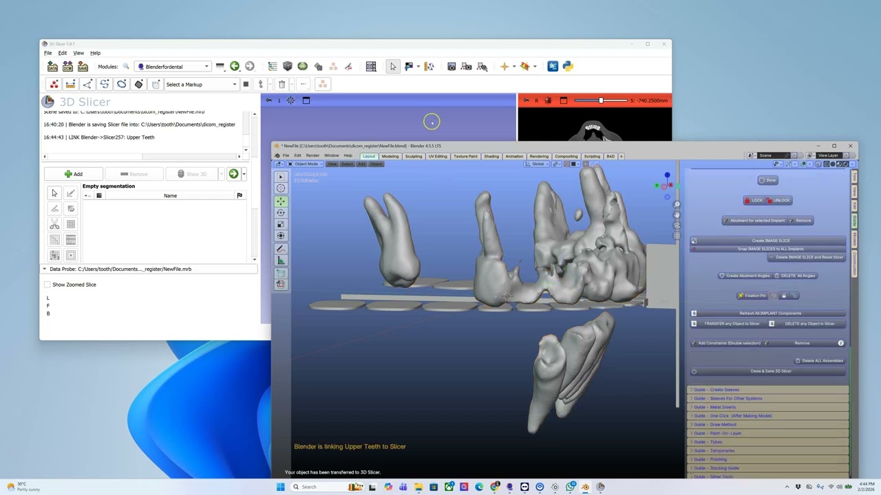 Файлы DICOM и модели находятся в неправильном месте в Blender.