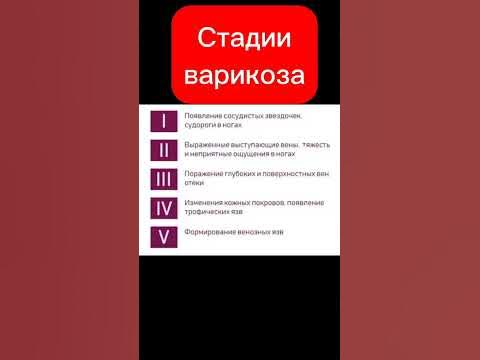 Стадии варикоза - YouTube