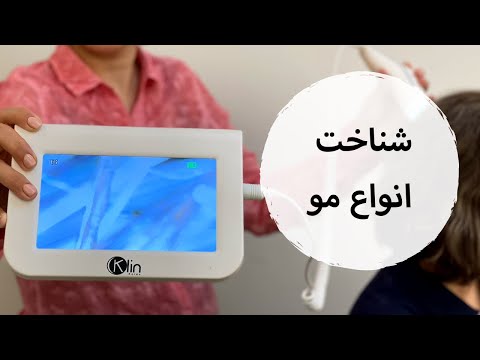 شناخت انواع مو