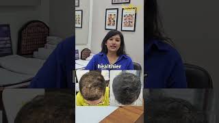 Dr Deeksha Sharma Hair Regrowth Treatments SkinWin