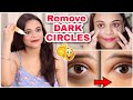 Remove UNDER EYES DARK CIRCLES 100% | Reasons & Remedy | SuperBeautyDezires