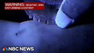 Video of discredited bite mark evidence helps free man from death row