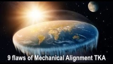 9 Flaws of Mechanical Alignment Total Knee Arthroplasty
