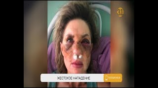 На психолога Светлану Божко напали во дворе дома