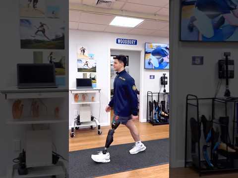 Above knee Amputee Man Walking with Disability #amputee #shorts