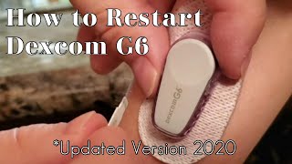 How to Restart Dexcom G6 Sensor | 2020