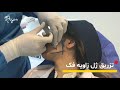 زاویه سازی و فرم دهی فک با تزریق ژل|کلینیک رویان سلامت