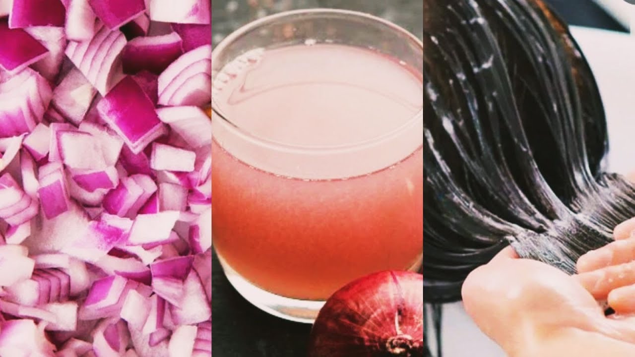 Onion Juice For Hair Regrowth Dandruff Hair fall Control Grey Hair