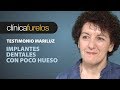 Mari Luz. Implantes dentales con poco hueso