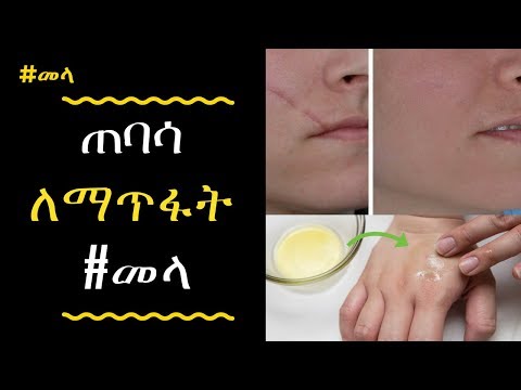 ቪዲዮ: የኪስ ቦርሳ ቆዳ ለማፅዳት 3 ቀላል መንገዶች