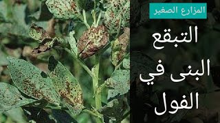 أعراض التبقع البنى في الفول | التبقع البنى في الفول