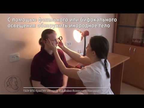 Удаление инородного тела из полости конъюнктивы