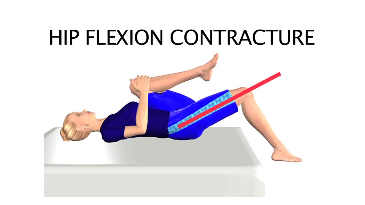 Posture LE new H 264 for iPad and iPhone 4