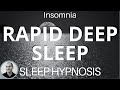 RAPID Deep Sleep ★ Gentle Sleep Hypnosis for Insomnia