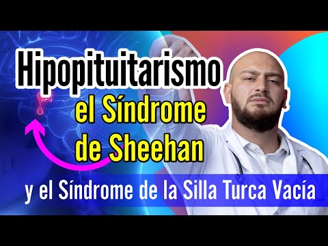 Video: Síndrome de Sheehan - Causas, Síntomas y Tratamiento