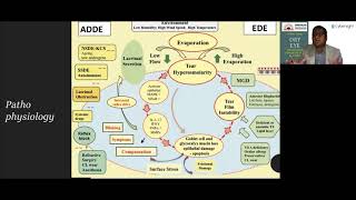 Lecture: Dry Eye: Evolving Diagnostics and Care