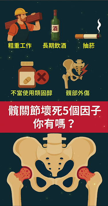 髖關節壞死的5個行為! 你中了哪幾項？