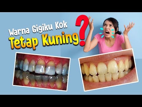 Video: Tips Menjaga Gigi Tetap Putih