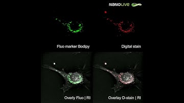 Revolutionizing lipid droplet analysis: AI-powered, label-free