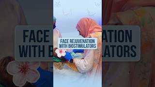Face Rejuvenation with Biostimulators ✨ #Biostimulator #FaceRejuvenation #CollagenStimulation