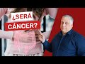 Los signos de CÁNCER DE COLON que no puedes ignorar